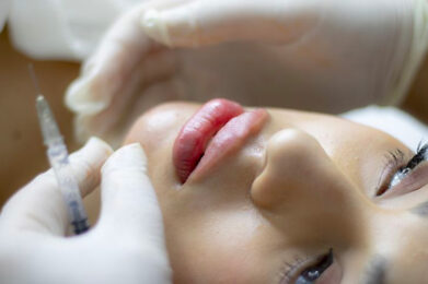 South Florida Lip Filler: Keeping Up With The Trends