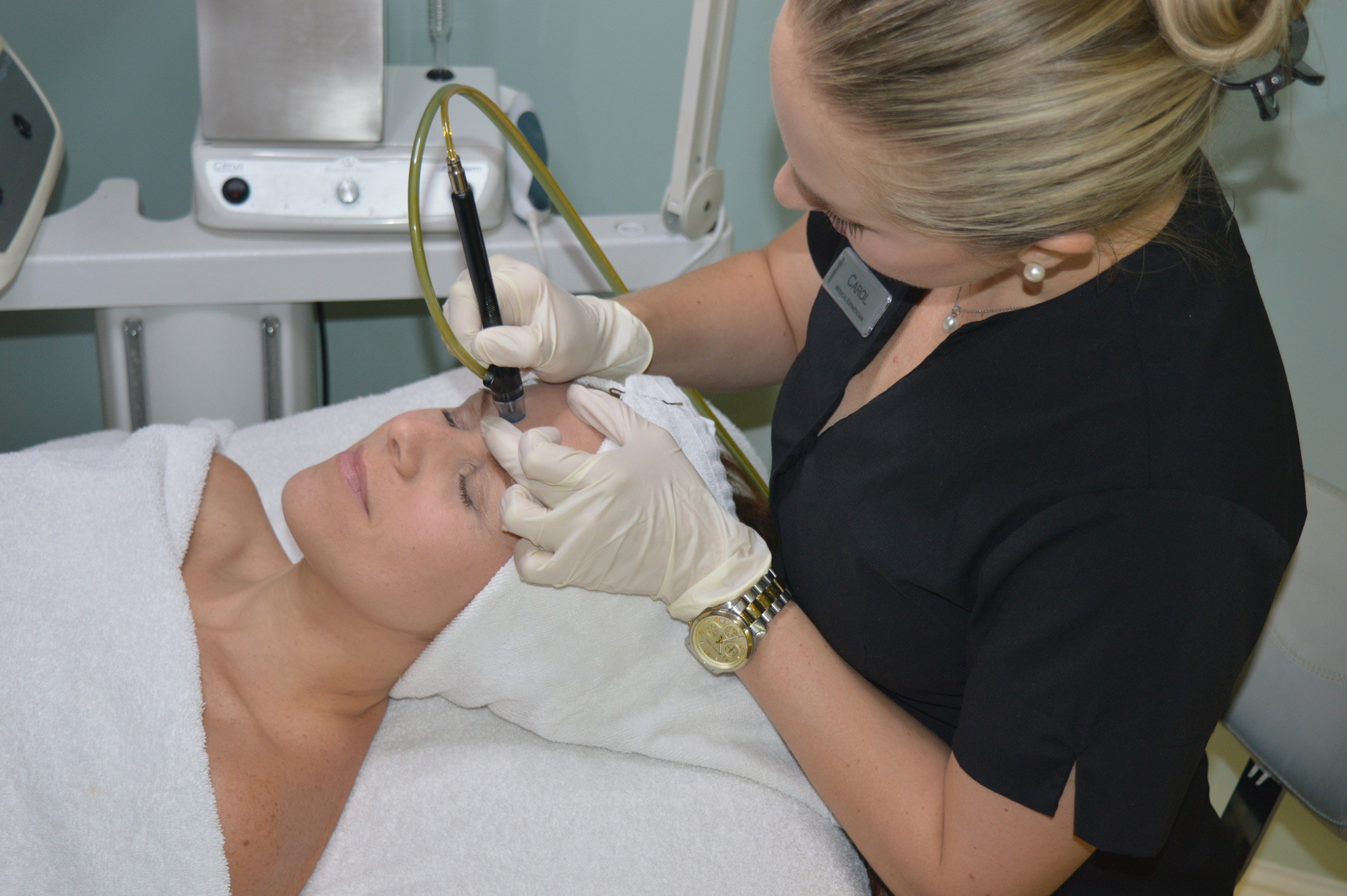microdermabrasion